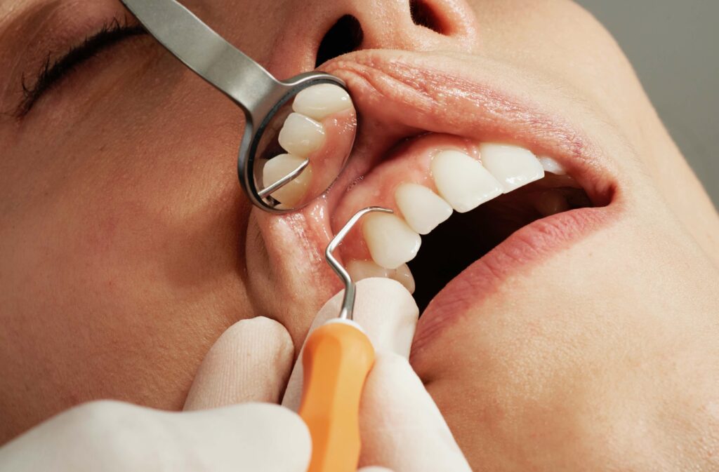 Limpeza dentária